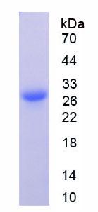 Recombinant Prominin 1 (PROM1)