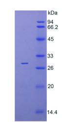 Recombinant Interleukin 1 Receptor Associated Kinase 4 (IRAK4)