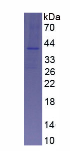 Recombinant Chemokine C-X3-C-Motif Receptor 1 (CX3CR1)