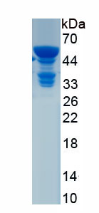 Recombinant Serum Amyloid P Component (SAP)