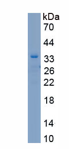 Recombinant Mannose Receptor C Type 1 (MRC1)