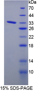 Recombinant Density Enhanced Phosphatase 1 (DEP1)