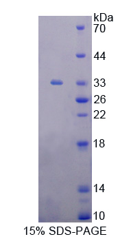 Recombinant Poliovirus Receptor (PVR)