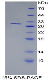 Recombinant Bone Marrow Stromal Cell Antigen 1 (BST1)