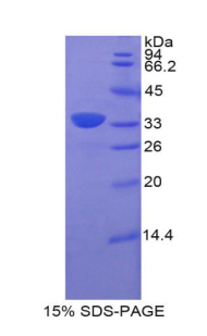 Recombinant Bone Marrow Stromal Cell Antigen 1 (BST1)