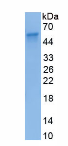 Recombinant Z-DNA Binding Protein 1 (ZBP1)