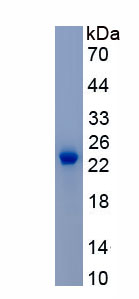 Recombinant Cofilin 1 (CFL1)