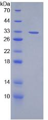 Recombinant Lymphotoxin Beta (LTb)