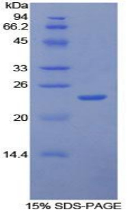 RPB567Hu01.jpg