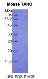 Recombinant Thymus Activation Regulated Chemokine (TARC)