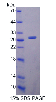 RPB572Ra01.jpg