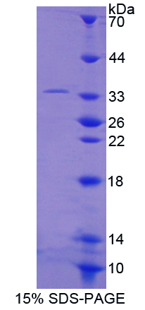 RPB577Hu01.jpg