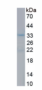 Recombinant Cluster Of Differentiation 32 (CD32)