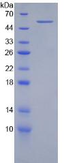 Recombinant Integrin Beta 2 (CD18)