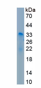 Recombinant Integrin Beta 2 (CD18)