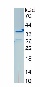 Recombinant Integrin Beta 2 (CD18)