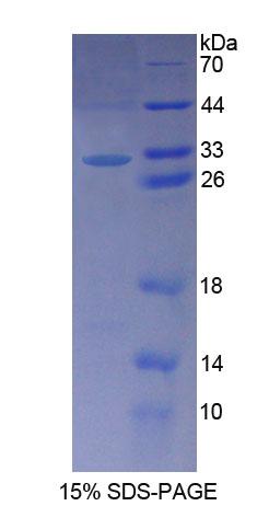 Recombinant Palladin (PALLD)