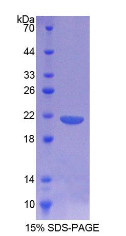 RPB594Ra01.jpg