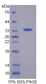 Recombinant Tyrosine Kinase 2 (Tyk2)