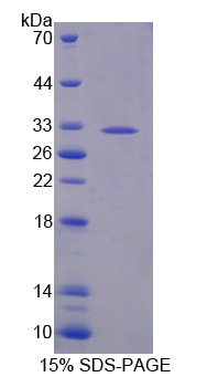 Recombinant Tyrosine Kinase 2 (Tyk2)