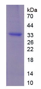 Recombinant Interferon Regulatory Factor 5 (IRF5)