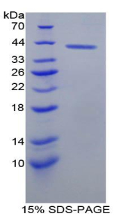 Recombinant B-Lymphocyte Chemoattractant (BLC)