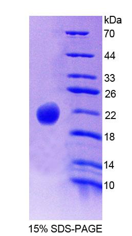 Recombinant Phospholipase C Beta 3, Phosphoinositide Specific (PLCb3)