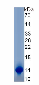 Recombinant Glucocorticoid Receptor (GR)