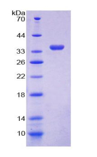 Recombinant GDP Dissociation Inhibitor 1 (GDI1)