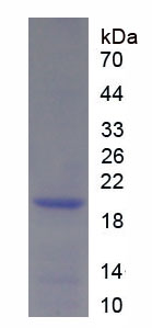 Recombinant C4 Binding Protein Alpha (C4BPa)