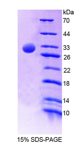 Recombinant C4 Binding Protein Alpha (C4BPa)