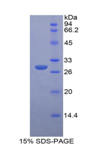 Recombinant Insulin Like Growth Factor 2 Receptor (IGF2R)