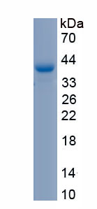 Recombinant Latent Transforming Growth Factor Beta Binding Protein 2 (LTBP2)