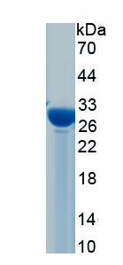 Recombinant Glucose Transporter 3 (GLUT3)