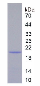 Recombinant Interleukin 12 Receptor Beta 1 (IL12Rb1)