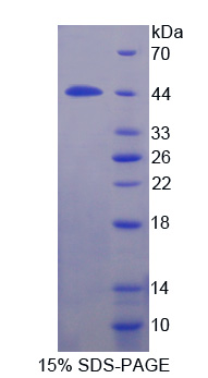 Recombinant Interleukin 12 Receptor Beta 1 (IL12Rb1)