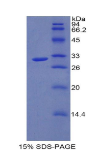 Recombinant Interleukin 17 Receptor A (IL17RA)