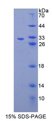 Recombinant Phosphoglycerate Mutase 2, Muscle (PGAM2)