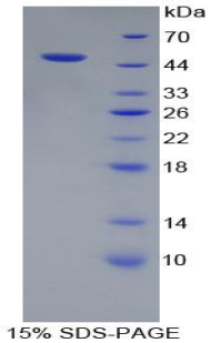 Recombinant Interleukin-18 Receptor Beta (IL18R Beta)