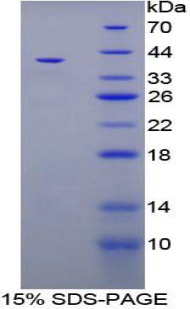 Recombinant Trefoil Factor 3 (TFF3)