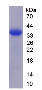 Recombinant Trefoil Factor 3 (TFF3)