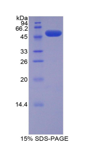 Recombinant Solute Carrier Family 27 Member 5 (SLC27A5)