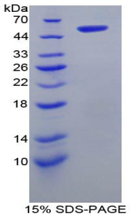 Recombinant Solute Carrier Family 27 Member 5 (SLC27A5)