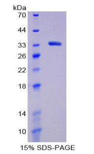 Recombinant Lymphocyte Activation Gene 3 (LAG3)