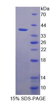 Recombinant Malonyl Coenzyme A Decarboxylase (MLYCD)