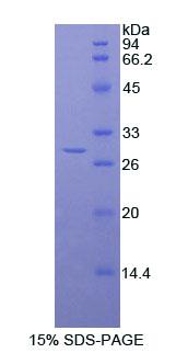 Recombinant Titin (TTN)