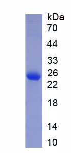 Recombinant Insulin Like Growth Factor Binding Protein 7 (IGFBP7)