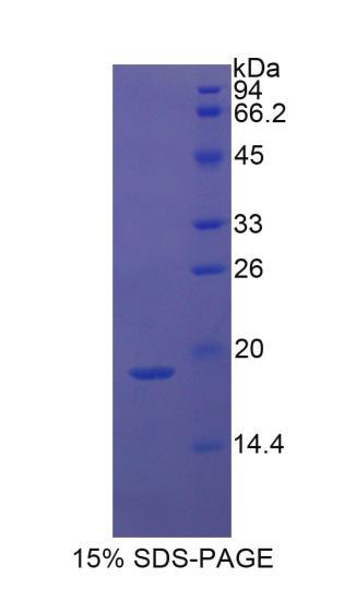 Recombinant Integrin Alpha M (CD11b)