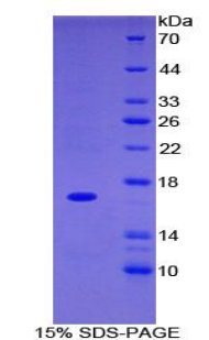 Recombinant Integrin Alpha M (CD11b)