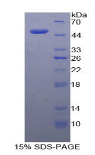 Recombinant Interleukin 21 (IL21)